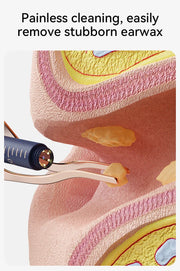 Upgraded Smart Visual Ear Wax Cleaner With Camera 800W HD Endoscope Multi-Functional Visual Ear Cleaning Tool Includes Storage